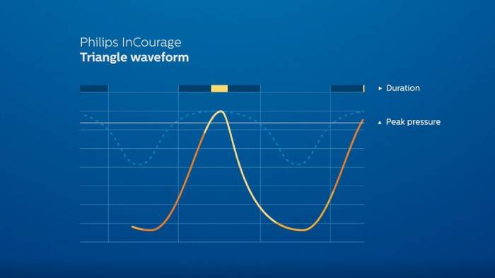 Philips InCourage system: Triangle waveform technology